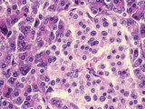 Buy Pancreas, X400 Islets of Langerhans at AllPosters.com