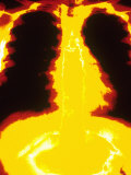 Buy Normal Chest X-Ray at AllPosters.com