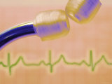 Stethoscope and ECG Print Out Heart Disease