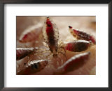 View of body lice feeding on a human wrist
