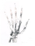 X-Ray Photograph of Hand of Person Photographic Print