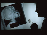 Radiologist Examines an X-Ray of a Human Head, USA