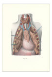 Buy Autopsy of Chest Cavity at AllPosters.com