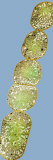 Buy A Chain of Anabaena Cyanobacteria Cells at AllPosters.com
