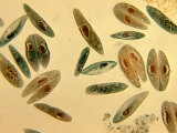 Paramecium Caudatum Ciliate Protozoa in Conjugation