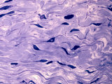 Collagen in Dense Connective Tissue