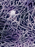 Gloeotrichia Cyanobacteria