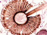 Aspergillus Niger Fungus with Conidial Head Found on a Soft Drink, Gms Stain