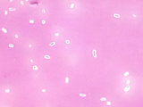 Klebsiella Pneumoniae Bacteria, One Cause of Pneumonia