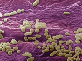 A Variety of Bacteria on the Surface of Human Skin