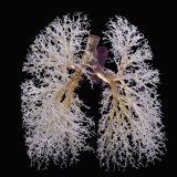 Resin Cast of Lungs, Bronchi Only, Anterior View