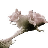 Buy Human Macrophage Moving Through Lung Tissue by Means of its Extended Pseudopod at AllPosters.com