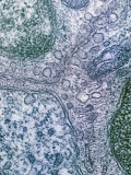 Pinocytic Vesicles in Smooth or Involuntary Muscle Cells