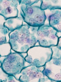 Cross-Section of Starch Granules in a Buttercup (Ranunculus) Young Root