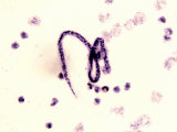 Wuchereria Bancrofti Parasitic Worm Microfilaria That Cause Elephantiasis
