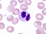 Buy Leukocyte in a Blood Smear from a Human Male Without a Drumstick. Brightfield at AllPosters.com