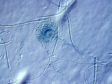 Aspergillus Fumigatus Fungus Conidiophore