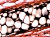 Elastic Cartilage in the Ear