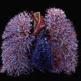 Resin Cast of Lungs, Heart, Blood Vessels, and Air Passages, Anterior View