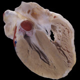 Buy A Lateral Section of the Human Heart Showing the Ventricles. Red, Right Auricle at AllPosters.com