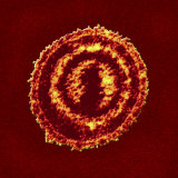 The Varicella Virus Is the Cause of Chickenpox