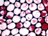 Collenchyma Tissue from a Celery Plant
