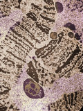 Fruit Fly, Drosophila, Polytene Chromosomes