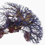 Resin Cast of Liver and Gall Bladder from Above