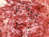 Dense Connective Tissue with Collagen and Elastic Fibers