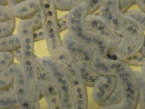American Toad Eggs (Bufo Americanus), Eastern North America