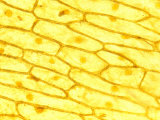 Buy Onion Cells with Visible Nuclei, Iodine Stain at AllPosters.com