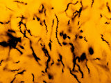 Treponema Pallidum Bacteria in Tissue, the Pathogen That Causes Syphilis
