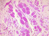 Buy Cross-Section of Skeletal Muscle Fibers from a Monkey Tongue at AllPosters.com