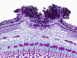 Cross-Section of an Elderberry Stem (Sambucus) Showing a Lenticel