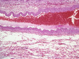 Human Artery Carrying Blood, Section Showing Muscular Walls