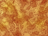 Polyribosomes on Rough Endoplasmic Reticulum, Rer,