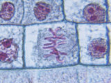 Metaphase Stage of Onion Mitosis (Allium)