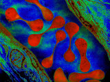 Buy Red Blood Cells, Erythrocytes, in a Vein Showing their Biconcave Shape at AllPosters.com