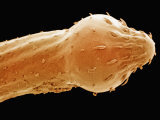 Buy Pomphorhynchus Bulbocolli, Boston Museum of Science at AllPosters.com