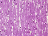 Human Cardiac Muscle Fibers