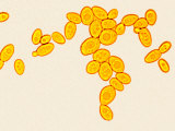 Baker's, Brewer's, or Commercial Yeast Budding, Saccharomyces Cerevisiae