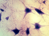 Multipolar Neurons