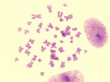 Buy Human Female Chromosome Spread Next to Cells. Brightfield at AllPosters.com