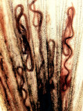 Nematode Worms, Philometroides, in a Fish Fin