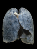 A Smoker's Damaged Lungs