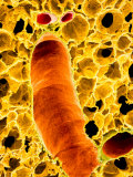 Buy Bronchioles and Numerous Surrounding Alveoli in the Lung at AllPosters.com