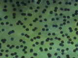 Wood Frog Eggs, Rana Sylvatica, North America