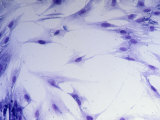 Buy Lung Fibroblast Cells at AllPosters.com