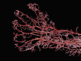 Resin Cast of Hand from Full Term Fetus, Showing Arterial Blood Supply