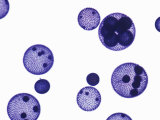 Buy Volvox Colonies, a Freshwater Green Algae at AllPosters.com